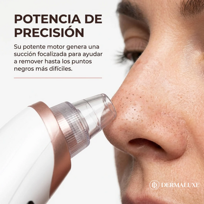 DERMOLUXE®: LIMPIADOR FACIAL LIMPIEZA PROFUNDA DE POROS Y PUNTOS NEGROS.